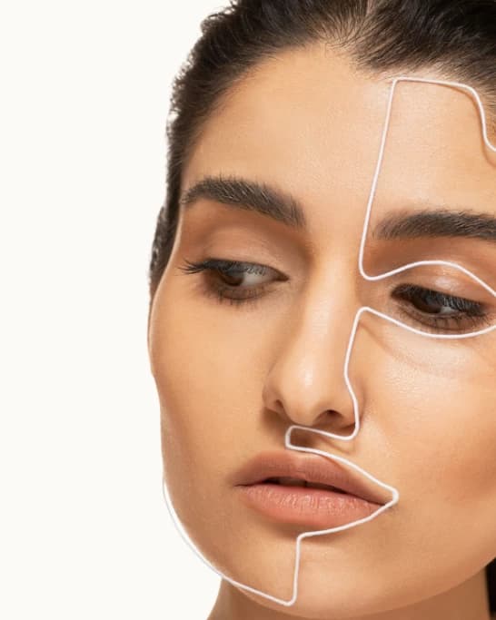 Mapa de armonización facial con zonas señaladas: pómulos, nariz, labios y mentón