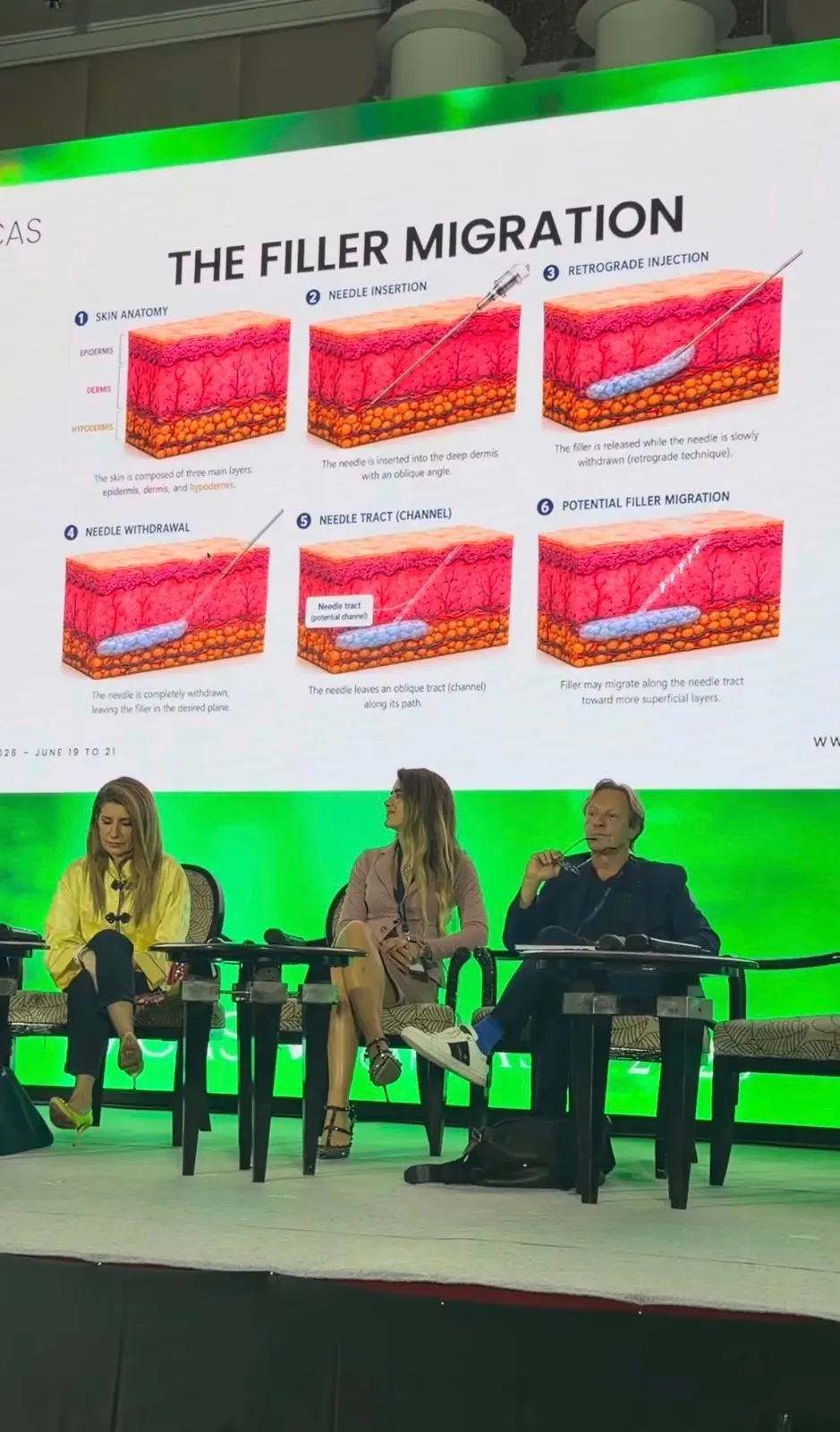 Panel de especialistas en el escenario frente a un esquema de las capas de la piel y el recorrido de la aguja